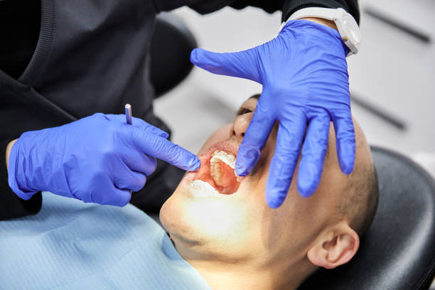 Best Emergency Dental Surgery in Ferguson, MO