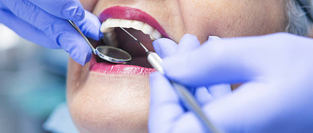 Best Weekend Emergency Dentist in Ferguson, MO